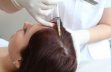Мезотерапия, как способ сохранения волос
