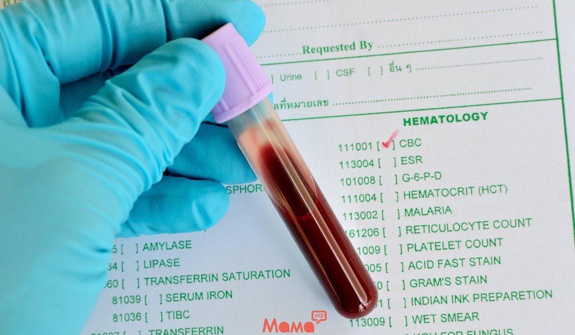 Что надо знать про развернутый анализ крови