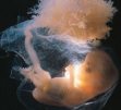 Эмбрион - тоже человек, считают матери