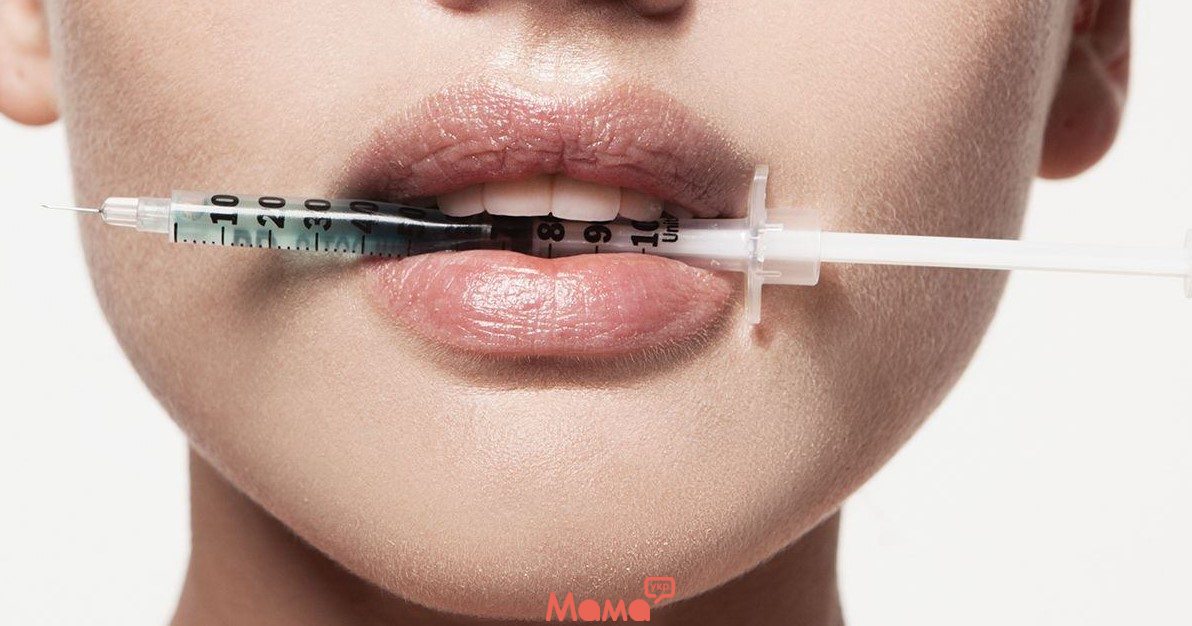 Збільшення губ вперше: що потрібно знати