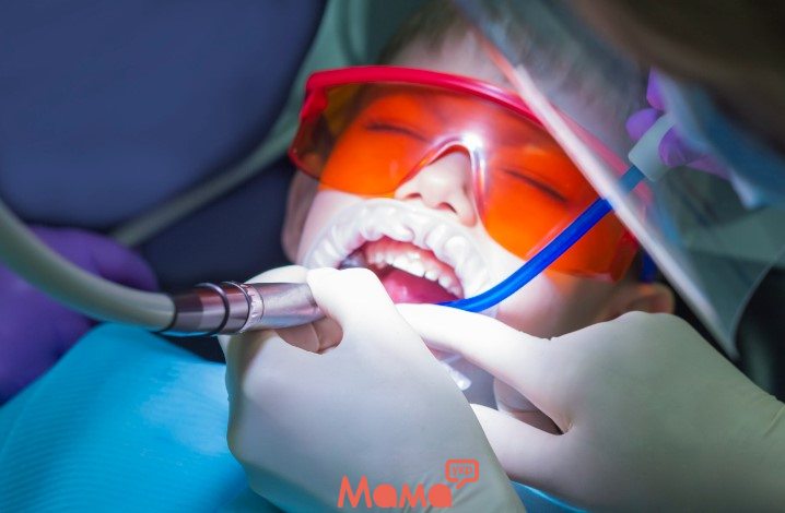 Лечение зубов ребенку в медикаментозном сне